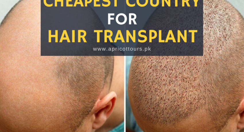 cheapest country for hair transplant