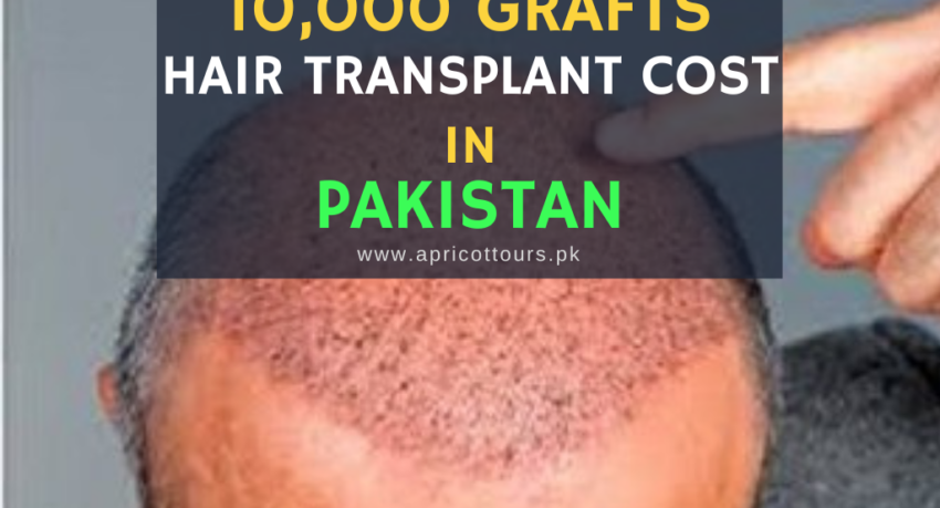 10000 grafts hair transplant cost in pakistan